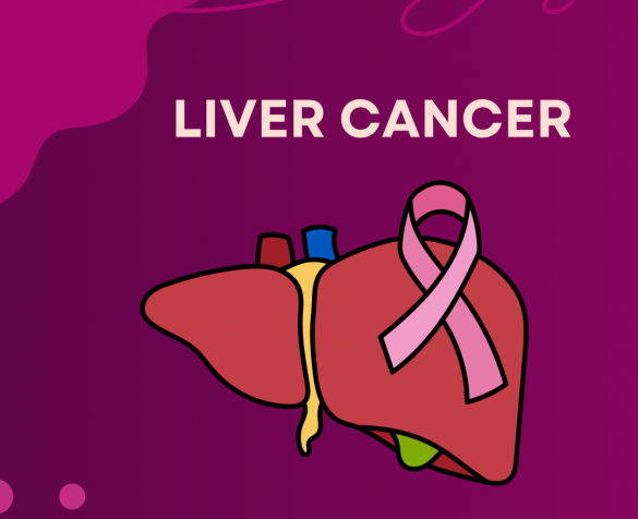 liver transplant in delhi