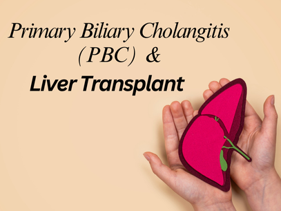 Primary Biliary Cholangitis (PBC) and Liver Transplant in Delhi
