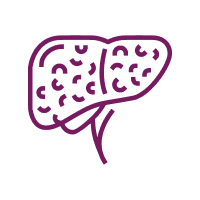 Liver Diseases
